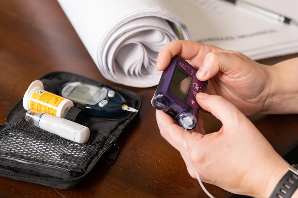 Woman working while using insulin pump and glucose meter to control type 1 diabetes