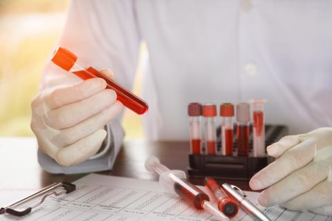 Person wearing gloves and holding a blood sample