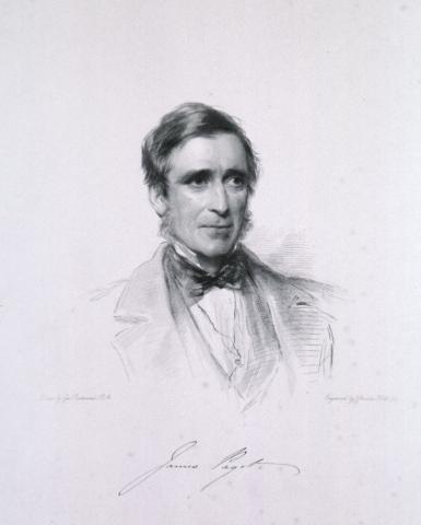 Sir James Paget